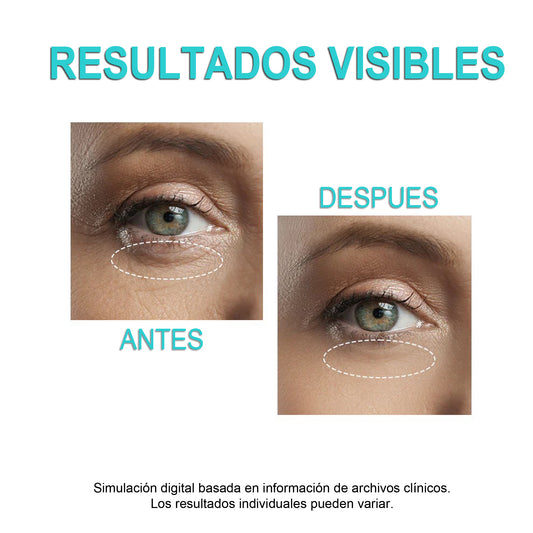 Sérum contorno de ojos antiarrugas iluminador