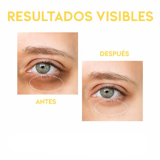Sérum contorno de ojos antimanchas y ojeras