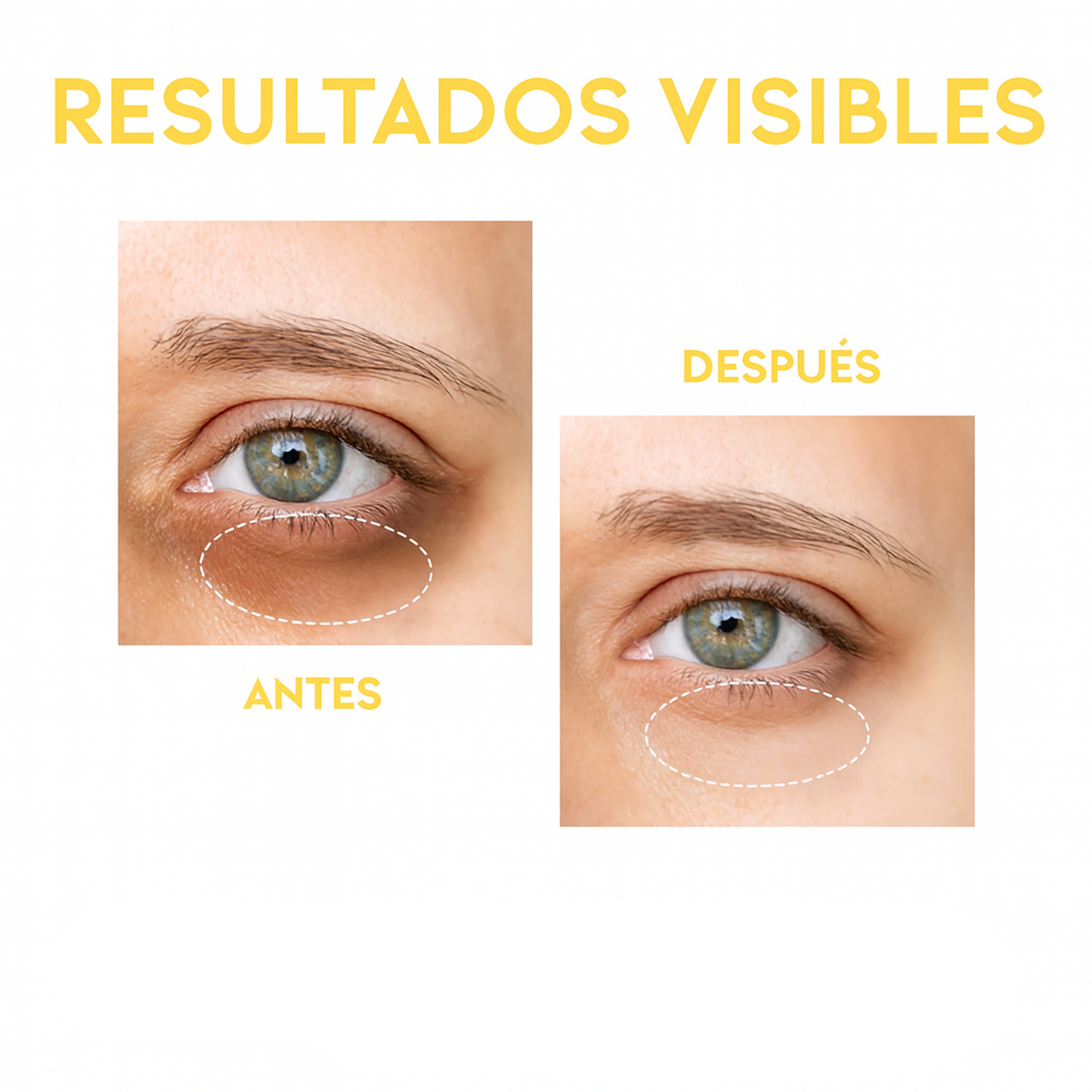 Sérum contorno de ojos antimanchas y ojeras