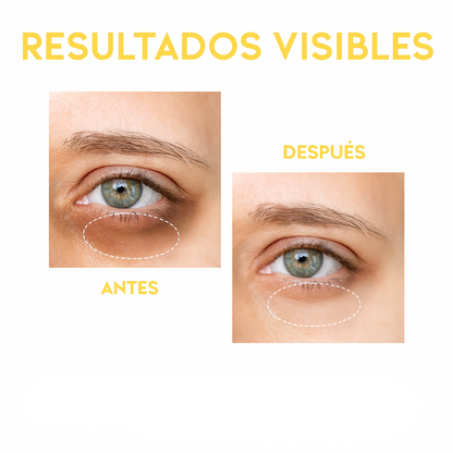 Sérum contorno de ojos antimanchas y ojeras